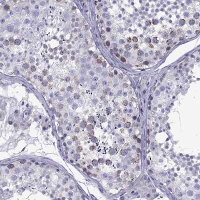 <b>Orthogonal Strategies Validation. </b>Immunohistochemistry-Paraffin: TDRD1 Antibody [NBP1-84349] - Staining of human testis shows high expression.