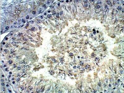 Immunohistochemistry-Paraffin: TDRD1 Antibody [NBP2-11487] - Rat Testis. 1:100 dilution. DAB (brown) staining and Hematoxylin QS (blue) counterstain. 40X magnification on Leica. FFPE section  