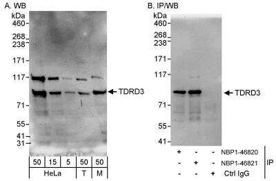 Western Blot: TDRD3 Antibody [NBP1-46821] - Samples:  Whole cell lysate from HeLa (5, 15 and 50 ug for WB; 1 mg for IP, 20% of IP loaded), 293T (T; 50 ug), and mouse NIH3T3 (M; 50 ug) cells.  Antibodies: Affinity purified rabbit anti-TDRD3 antibody NBP1-46821 used for WB at 0.1 ug/ml (A) and 0.4 ug/ml (B) and used for IP at 3 ug/mg lysate.  TDRD3 was also immunoprecipitated by rabbit anti-TDRD3 antibody NBP1-46820, which recognizes an upstream epitope.   Detection: Chemiluminescence with exposure times of 3 minutes (A) and 30 seconds (B).
