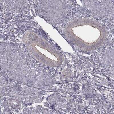 Immunohistochemistry-Paraffin TDRD5 Antibody