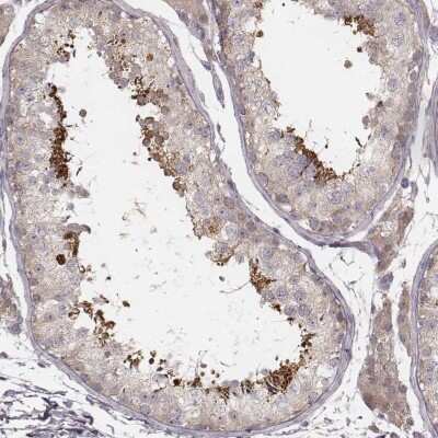 Immunohistochemistry-Paraffin TDRD5 Antibody