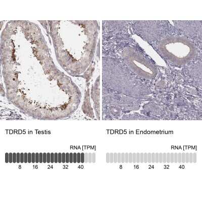 Immunohistochemistry-Paraffin TDRD5 Antibody