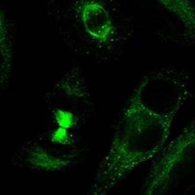 Immunocytochemistry/Immunofluorescence: TDRD6 Antibody [NBP3-16968] - Staining of human cell line HeLa shows localization to microtubules, cytokinetic bridge, mitotic spindle & vesicles.
