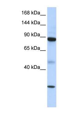 Western Blot TDRD9 Antibody