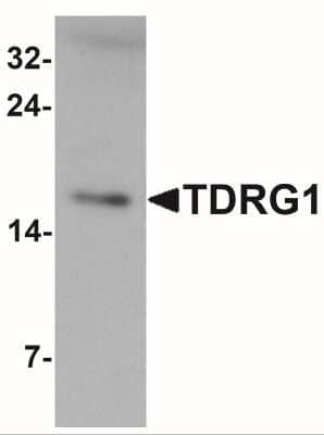 Western Blot: TDRG1 Antibody [NBP2-41197] - Western blot analysis of TDRG1 in human testis tissue lysate with TDRG1 antibody at 1 ug/mL.