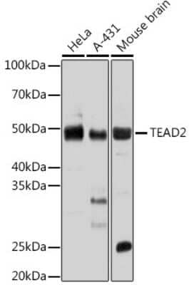 Western Blot: TEAD2 Antibody [NBP3-05267] - Analysis of extracts of various cell lines, using TEAD2 antibody (NBP3-05267) at 1:1000 dilution. Secondary antibody: HRP Goat Anti-Rabbit IgG (H+L) at 1:10000 dilution. Lysates/proteins: 25ug per lane. Blocking buffer: 3% nonfat dry milk in TBST. Detection: ECL Basic Kit. Exposure time: 60s.