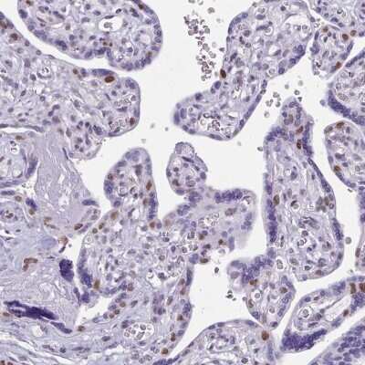 Immunohistochemistry-Paraffin: TEAD4 Antibody [NBP2-33803] - Staining of human placenta shows moderate nuclear positivity in trophoblastic cells.