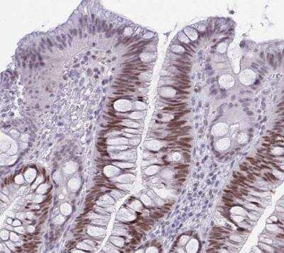 Immunohistochemistry-Paraffin: TEAD4 Antibody [NBP2-33803] - Staining of human colon shows moderate nuclear positivity in glandular cells.