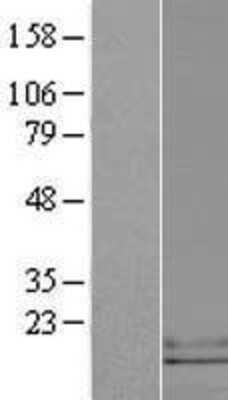 Western Blot CCL25/TECK Overexpression Lysate