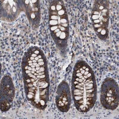 Immunohistochemistry-Paraffin: TECPR1 Antibody [NBP1-84206] - Staining of human colon shows strong cytoplasmic positivity in glandular cells.