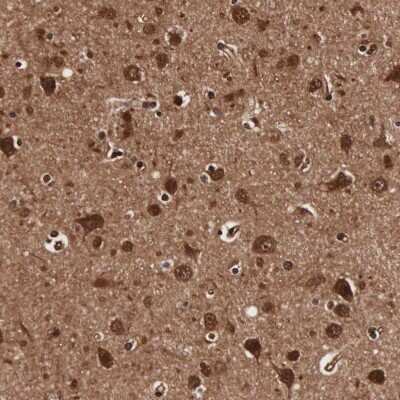 Immunohistochemistry-Paraffin TECPR2 Antibody - BSA Free