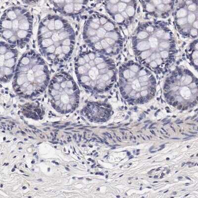 Immunohistochemistry-Paraffin TECPR2 Antibody - BSA Free