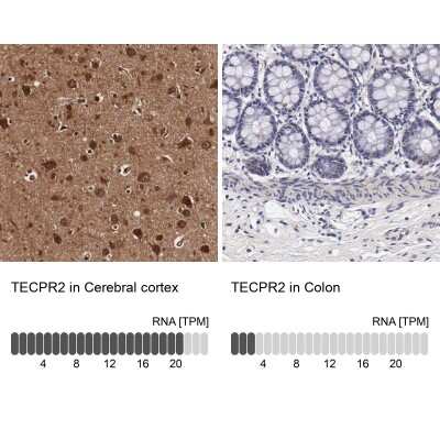 Immunohistochemistry-Paraffin TECPR2 Antibody - BSA Free