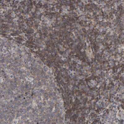 Immunohistochemistry-Paraffin: TEFM Antibody [NBP1-82109] - Staining of human lymphoid tissues shows strong cytoplasmic positivity in non-germinal center cells.