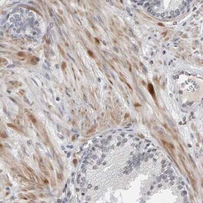 Immunohistochemistry-Paraffin: TEFM Antibody [NBP1-82109] - Staining of human prostate shows weak to moderate cytoplasmic positivity in smooth muscle cells.