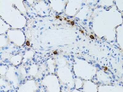 Immunohistochemistry-Paraffin: TEFM Antibody [NBP2-94080] - Paraffin-embedded rat lung using TEFM .