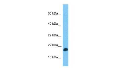 Western Blot: TEFM Antibody [NBP2-85899] - Host: Rabbit. Target Name: TEFM. Sample Type: Fetal Brain lysates. Antibody Dilution: 1.0ug/ml