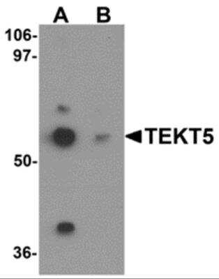 Western Blot TEKT5 Antibody - BSA Free