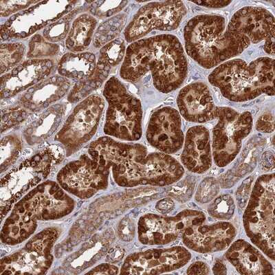 Immunohistochemistry-Paraffin: TEL2 Antibody [NBP1-81762] - Staining of human kidney shows strong cytoplasmic positivity in cells in tubules.