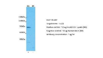 Western Blot: TEL2 Antibody [NBP2-85900] - Host: Rabbit. Target: TELO2. Positive control (+): HepG2 Cell Lysate (HG). Negative control (-): Human Brain (BR). Antibody concentration: 1ug/ml