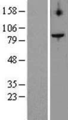 Western Blot: TEL2 Overexpression Lysate (Adult Normal) [NBL1-16813] Left-Empty vector transfected control cell lysate (HEK293 cell lysate); Right -Over-expression Lysate for TEL2.