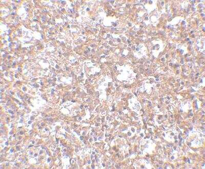 Immunohistochemistry-Paraffin: TEM4 Antibody [NBP1-77314] - Human spleen tissue with TEM4 antibody at 2.5 ug/ml.