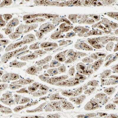 Immunohistochemistry-Paraffin: TEM4 Antibody [NBP1-87862] - Staining of human heart muscle shows strong cytoplasmic positivity in myocytes.