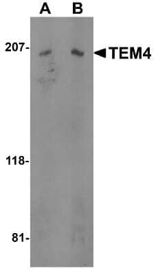 Western Blot: TEM4 Antibody [NBP1-77314] - Analysis of TEM4 in Jurkat cell lysate with TEM4 antibody at (A) 0.5 and (B) 1 ug/mL.