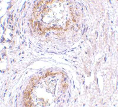 Immunohistochemistry-Paraffin: TEM5/GPR124 Antibody [NBP1-77315] - Human bladder tissue with GPR124 antibody at 5 ug/ml.