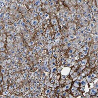 Immunohistochemistry-Paraffin: TEM5/GPR124 Antibody [NBP1-85138] - Staining of human liver shows strong membranous positivity in hepatocytes.