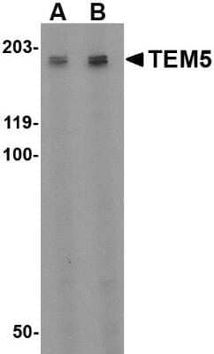 Western Blot: TEM5/GPR124 Antibody [NBP1-76844] - Rat kidney tissue lysate with GPR124 antibody at (A) 2 ug/ml and (B) 4 ug/ml.