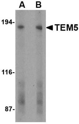 Western Blot: TEM5/GPR124 Antibody [NBP1-77315] - Human bladder tissue lysate with GPR124 antibody at (A) 2 and (B) 4 ug/ml.