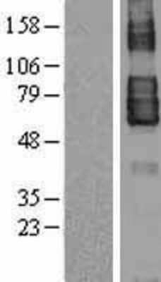 Western Blot: TEM7 Overexpression Lysate (Adult Normal) [NBL1-14532] Left-Empty vector transfected control cell lysate (HEK293 cell lysate); Right -Over-expression Lysate for TEM7.