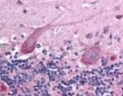 Immunohistochemistry TEM7/PLXDC1 Antibody (197C193 (IM193)) - BSA Free