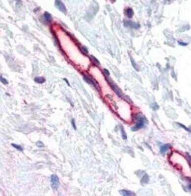 Immunohistochemistry-Paraffin TEM7/PLXDC1 Antibody (197C193 (IM193)) - BSA Free