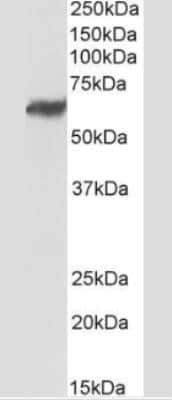 Western Blot TEM7/PLXDC1 Antibody (197C193 (IM193)) - BSA Free
