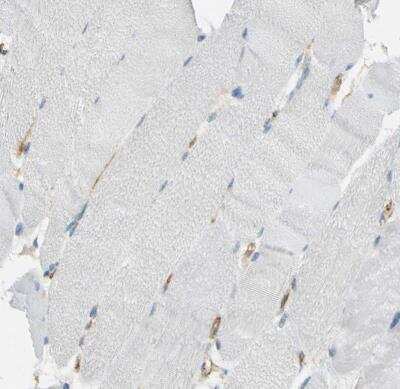 Immunohistochemistry-Paraffin: TEM7/PLXDC1 Antibody [NBP1-86954] - Staining of human skeletal muscle shows no positivity in striated muscle fibers as expected. Endothelial cells are positive.