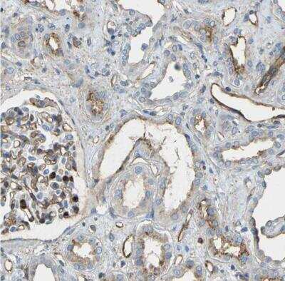 Immunohistochemistry-Paraffin: TEM7/PLXDC1 Antibody [NBP1-86954] - Staining of human kidney shows moderate to strong membranous positivity in endothelial cells of blood vessels and renal glomeruli.
