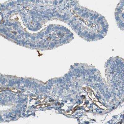 Immunohistochemistry-Paraffin: TEM7/PLXDC1 Antibody [NBP1-86954] - Staining of human fallopian tube shows moderate membranous positivity in endothelial cells.