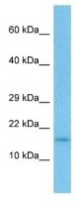 Western Blot: TEN1 Antibody [NBP3-10120] - Western blot analysis of TEN1 in Mouse Heart lysates. Antibody dilution at 1ug/ml