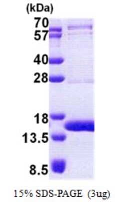 SDS-Page: TEN1 Protein [NBP2-22855]