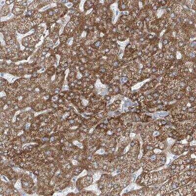 Immunohistochemistry: TENC1 Antibody [NBP1-90698] - Staining of human liver shows moderate cytoplasmic positivity in hepatocytes.