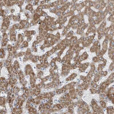 Immunohistochemistry-Paraffin TENC1 Antibody - BSA Free