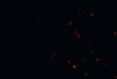 Immunofluorescence: TEP1 Antibody [NBP1-03224] - Immunofluorescence of TEP1 in Human Lung cells with TEP1 antibody at 20 ug/ml.