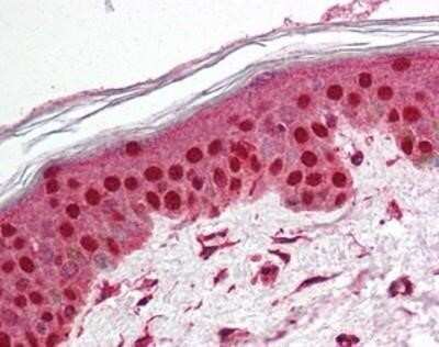Immunohistochemistry-Paraffin: TEP1 Antibody [NBP1-03224] - Staining of human skin. Immunohistochemistry of formalin-fixed, paraffin-embedded tissue after heat-induced antigen retrieval. Antibody concentration 5 ug/ml.