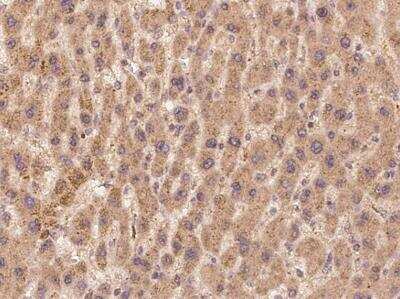 Immunohistochemistry-Paraffin: TEP1 Antibody [NBP3-05903] - Staining of human TEP1 in human liver with rabbit polyclonal antibody at 1:100 dilution.