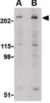 Western Blot: TEP1 Antibody [NBP1-03224] - Western blot of TEP1 in human kidney tissue lysate with TEP1 antibody at (A) 1 and (B) 2 ug/ml.