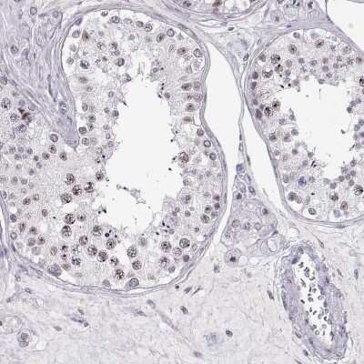 Immunohistochemistry-Paraffin: TEPP Antibody [NBP2-57214] - Staining of human testis shows high expression.