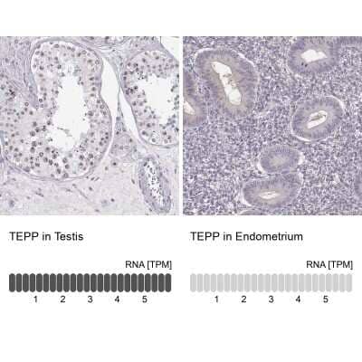 Immunohistochemistry-Paraffin: TEPP Antibody [NBP2-57214] - Staining in human testis and endometrium tissues using anti-TEPP antibody. Corresponding TEPP RNA-seq data are presented for the same tissues.