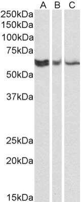 Western Blot: TERF21P Antibody (78B356.1) [NB100-56526] - Western blot analysis of A431 (A), HEK293 (B) and HeLa (C)  lysates (35ug per lane, RIPA buffer) using TERF21P antibody (NB100-56526) at 0.1ug/ml. Band observed at ~60kDa.